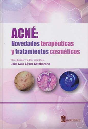Acné. Novedades terapéuticas y tratamientos cosméticos